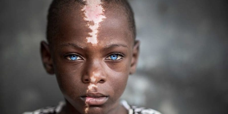 صورة بعنوان شاكول (صبي مصاب بمتلازمة واردينبيرغ)، للمصور الإماراتي بول-فلاد إبور