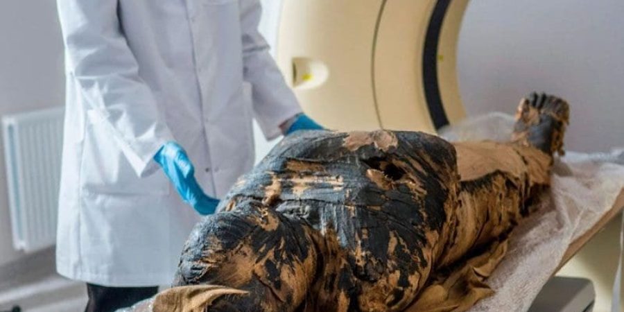 "مشروع مومياء وارسو" كشف عن أول حالة معروفة لمومياء مصرية قديمة حامل (الفرنسية)