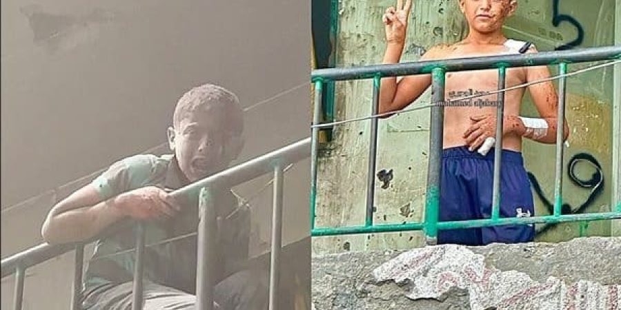 جريح ناجي من مجزرة جيش الاحتلال