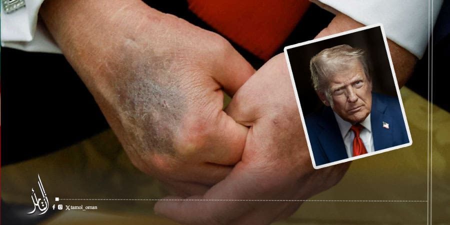 ترامب حقيقة وفاة دونالد ترامب