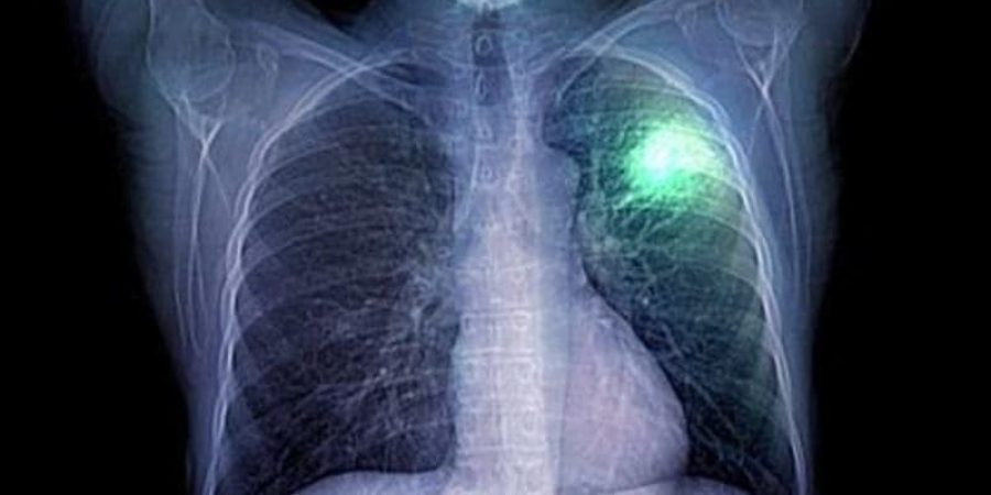 تعبيرية عن المرض